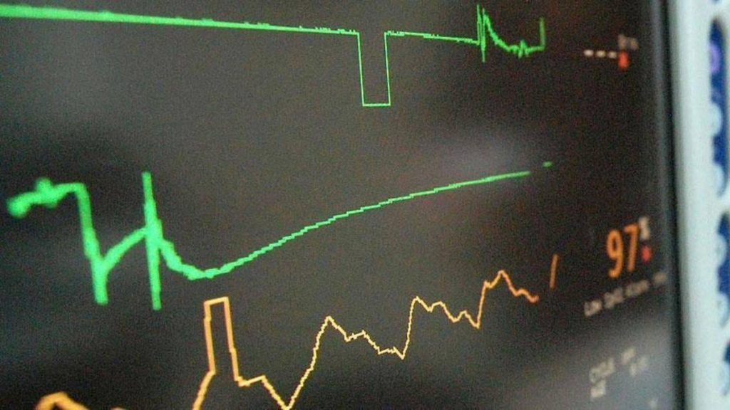 Türkiye’de her yıl yaklaşık 300 bin kişi kalp krizi geçiriyor