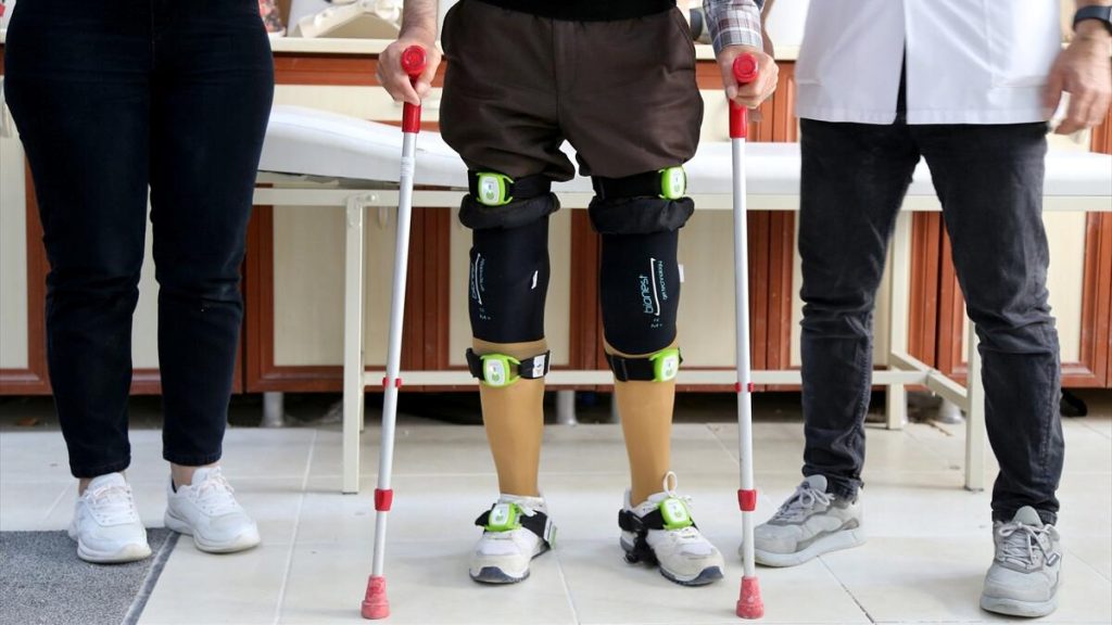 Trakya Üniversitesi’nde depremzedeye protez bacaklar yapıldı